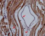 NaV1.5 (SCN5A) (1978-2016) Antibody in Immunohistochemistry (Paraffin) (IHC (P))