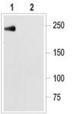 NaV1.5 (SCN5A) (1978-2016) Antibody in Western Blot (WB)