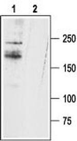 SCN11A (NaV1.9) Antibody in Western Blot (WB)