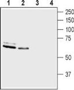 ASIC3 Antibody in Western Blot (WB)