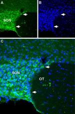 NALCN/VGCNL1 (extracellular) Antibody in Immunohistochemistry (IHC)