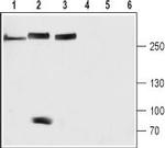 NALCN/VGCNL1 (extracellular) Antibody in Western Blot (WB)