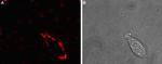 SCN4B (NaV beta 4) (extracellular) Antibody in Immunocytochemistry (ICC/IF)