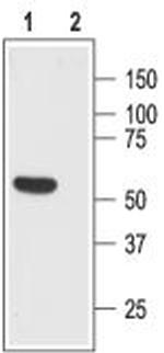 Somatostatin Receptor Type 1 (extracellular) Antibody in Western Blot (WB)