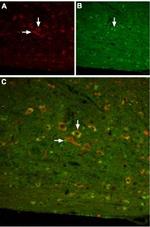 Somatostatin Receptor Type 3 Antibody in Immunohistochemistry (IHC)