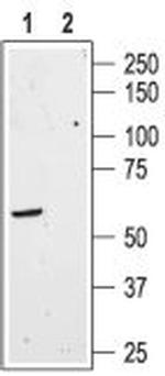 Somatostatin Receptor Type 3 Antibody in Western Blot (WB)