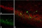 Somatostatin Receptor Type 4 (extracellular) Antibody in Immunohistochemistry (IHC)