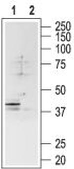 Somatostatin Receptor Type 4 (extracellular) Antibody in Western Blot (WB)