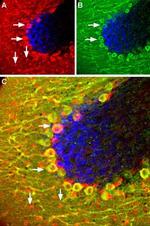 Somatostatin Receptor Type 5 (extracellular) Antibody in Immunohistochemistry (IHC)