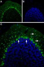 5HT2B Receptor (HTR2B) (extracellular) Antibody in Immunohistochemistry (IHC)