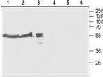 TRIC-B (TMEM38B) Antibody in Western Blot (WB)