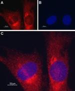 TRIC-A (TMEM38A) Antibody in Immunocytochemistry (ICC/IF)