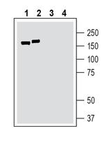 TMC1 (extracellular) Antibody in Western Blot (WB)