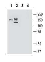 TMC1 (extracellular) Antibody in Western Blot (WB)