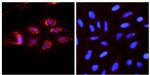 ATG9A Antibody in Immunocytochemistry (ICC/IF)