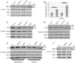 ATP Synthase beta Antibody in Western Blot (WB)