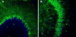 TSH Receptor (TSHR) (extracellular) Antibody in Immunohistochemistry (IHC)