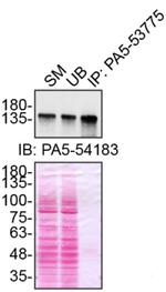 Ataxin 2 Antibody in Immunoprecipitation (IP)