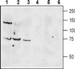 VPAC1 (VIPR1) (extracellular) Antibody in Western Blot (WB)