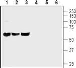 PACAP Receptor 1 (PAC1) Antibody in Western Blot (WB)