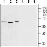 Vasopressin V1A Receptor (AVPR1A) Antibody in Western Blot (WB)