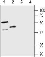 Vasopressin V1B Receptor (AVPR1B) Antibody in Western Blot (WB)