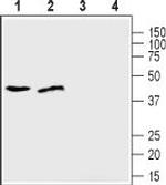 ZIP1 (SLC39A1) (extracellular) Antibody in Western Blot (WB)