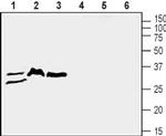 ZIP3 (SLC39A3) Antibody in Western Blot (WB)