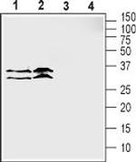 ZIP3 (SLC39A3) Antibody in Western Blot (WB)