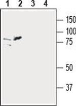 ZIP6/SLC39A6 (extracellular) Antibody in Western Blot (WB)