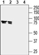 ZIP8 (SLC39A8) (extracellular) Antibody in Western Blot (WB)