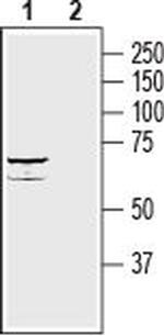 ZIP8 (SLC39A8) (extracellular) Antibody in Western Blot (WB)