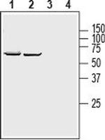 ZIP8 (SLC39A8) (extracellular) Antibody in Western Blot (WB)