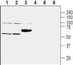 ZnT1 (SLC30A1) Antibody in Western Blot (WB)