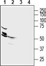 ZnT2 (SLC30A2) Antibody in Western Blot (WB)