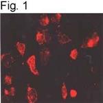 beta-1 Adrenergic Receptor Antibody in Immunohistochemistry (IHC)