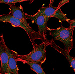 AKT Pan Antibody in Immunocytochemistry (ICC/IF)