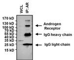 Androgen Receptor Antibody in Immunoprecipitation (IP)