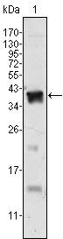 Androgen Receptor Antibody in Western Blot (WB)