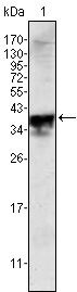 Androgen Receptor Antibody in Western Blot (WB)