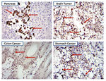 STAT3 Antibody in Immunohistochemistry (IHC)