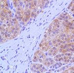 Arginase 1 Antibody in Immunohistochemistry (Paraffin) (IHC (P))