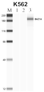 BAZ1A Antibody in RNA Immunoprecipitation (RIP)