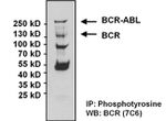 BCR-ABL Antibody in Western Blot (WB)