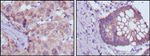 BDH1 Antibody in Immunohistochemistry (Paraffin) (IHC (P))