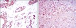 BMPR2 Antibody in Immunohistochemistry (Paraffin) (IHC (P))