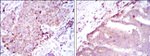 BMPR2 Antibody in Immunohistochemistry (Paraffin) (IHC (P))