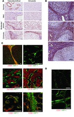 VAP-1 Antibody in Immunohistochemistry (IHC)