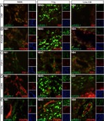 FAP Antibody in Immunohistochemistry (IHC)