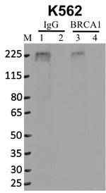 BRCA1 Antibody in Immunoprecipitation (IP)